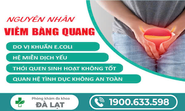 Hình ảnh minh họa